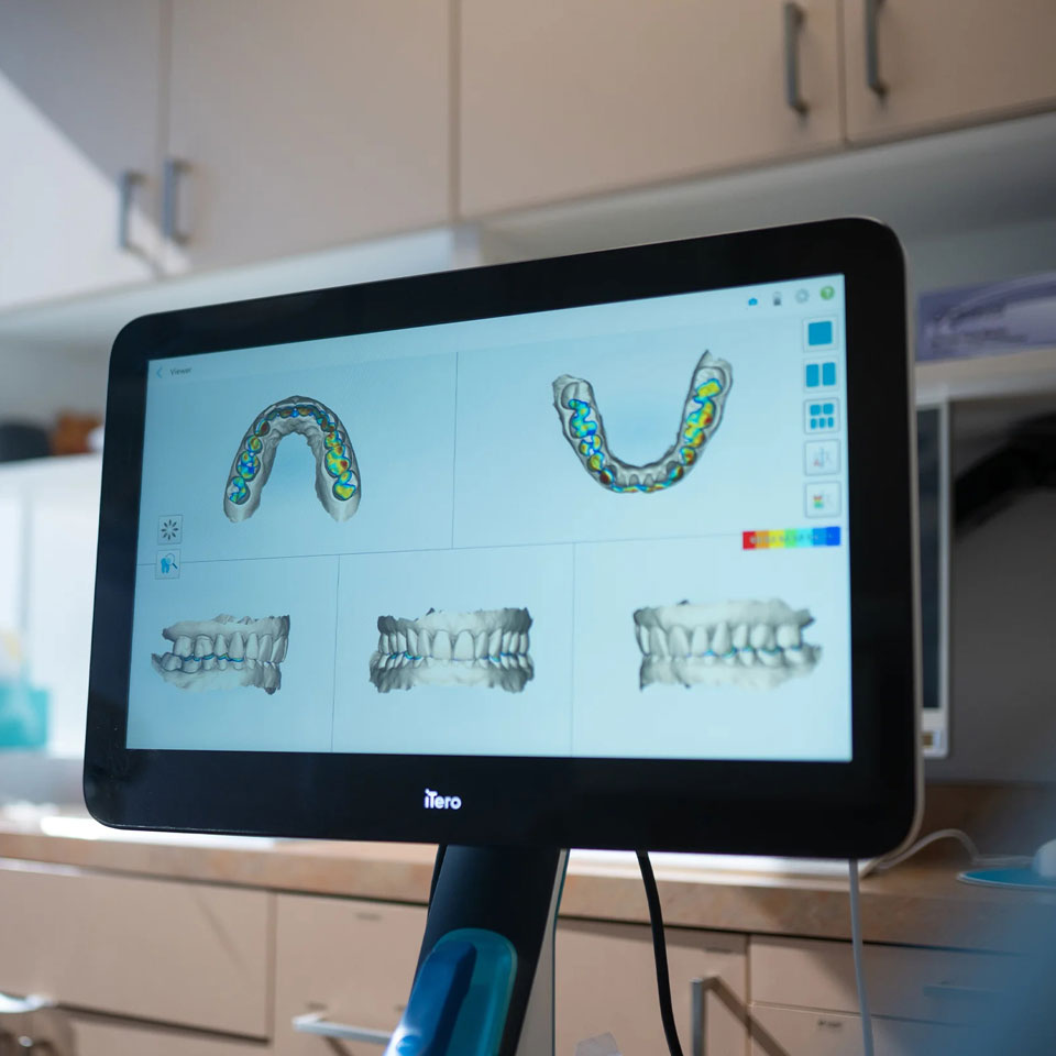 Invisalign Santa Monica
